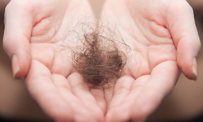 Alopecia Iatrogena