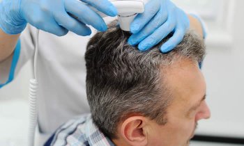 In questo articolo Parliamo degli esami da effettuare per capire le cause della caduta dei capelli, analizzando nel dettaglio le tecniche diagnostiche più diffuse.