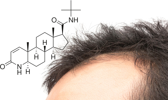 Finasteride per i Capelli