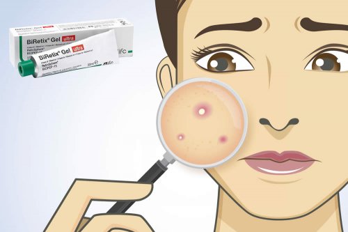 In questa recensione parliamo di Biretix Gel Ultra (utile nel trattamento dell'acne volgare, ad azione esfoliante, idratante e antiossidante), analizzandone ingredienti, prezzo, efficacia, modo d'uso e controindicazioni