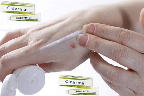 In questa recensione parliamo di Ciderma (farmaco omeopatico prescritto dai medici omeopati per lenire le irritazioni cutanee e favorire la cicatrizzazione delle lesioni), analizzandone ingredienti, efficacia, modo d'uso ed effetti collaterali