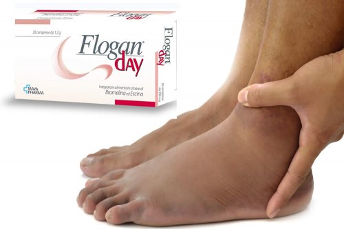 In questa recensione parliamo di Flogan Day (integratore a base di bromelina ed escina, a elevata attività antinfiammatoria e antiedemigena), analizzandone ingredienti, efficacia, modo d'uso, benefici, controindicazioni ed effetti collaterali