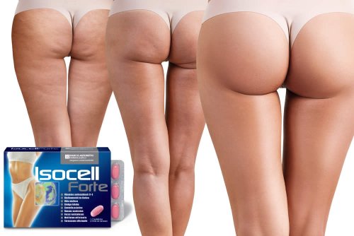 In questa recensione parliamo dell'Integratore Isocell Forte (utile in caso di cellulite per l'azione drenante, capillaroprotettrice e brucia grassi), analizzandone ingredienti, composizione, efficacia, modo d'uso, controindicazioni, effetti collaterali