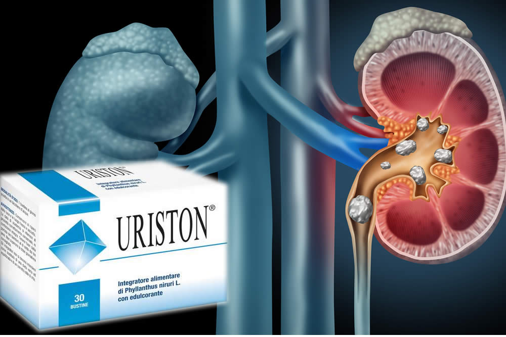 Uriston Plus