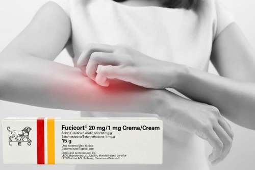 Recensione del Farmaco Fucicort Crema: A Cosa Serve? Quando Fa bene? Quando Fa Male? Per Cosa si Usa? Dosi e Uso Corretto contro le Infiammazioni e le Infezioni Cutanee. Foglio Illustrativo Spiegato, Controindicazioni ed Effetti Collaterali
