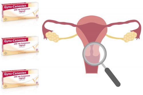 Recensione Gyno-Canesten Capsule Vaginali: A Cosa Servono? Per Cosa si Usano? Funzionano contro la Candida? Dosi e Uso Corretto contro la Candida. Foglietto Illustrativo Spiegato, Controindicazioni, Prezzo ed Effetti Collaterali