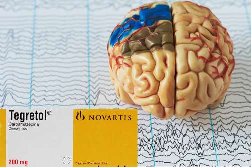 Recensione del Farmaco Tegretol Compresse e Sciroppo: Quando Fa bene? Quando Fa Male? Per Cosa si Usa? Dosi e Uso Corretto della Carbamazepina come Antiepilettico. Foglio Illustrativo Spiegato, Controindicazioni ed Effetti Collaterali