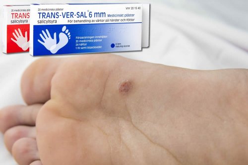 Recensione del Farmaco Trans-Ver-Sal: A Cosa Serve? Quando Fa bene? Quando Fa Male? Dosi e Uso Corretto per Rimuovere Calli, Duroni e Verruche. Uso in Gravidanza, Prezzo Trans Ver Sal, Controindicazioni ed Effetti Collaterali