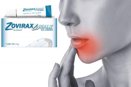 Recensione del Farmaco Zovirax Labiale: A Cosa Serve? Quando Fa bene? Quando Fa Male? Per Cosa si Usa? Dosi e Uso Corretto dell'Aciclovir conto l'Herpes delle Labbra. Prezzo Zovirax Labiale Crema, Uso ed Effetti Collaterali