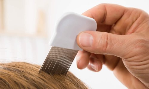 I pettini antipidocchi sono una soluzione semplice ed economica al problema dei Pidocchi dei Capelli. Usarli nella maniera corretta è tuttavia essenziale. Vediamo quindi quali prodotti offre il mercato e come sceglierli e usarli al meglio