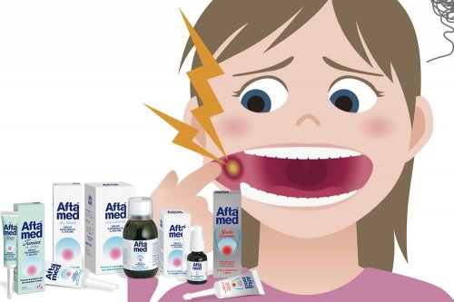 In questa recensione parliamo dei prodotti Aftamed (dispositivi medici utili per il trattamento delle afte della bocca, grazie all'attività protettiva dell'acido ialuronico), analizzandone caratteristiche, vantaggi, prezzo, uso e controindicazioni
