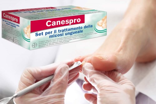 In questa recensione parliamo di Canespro (Dispositivo Medico contenente un set - crema, cerotto e raschietto - per un trattamento completo delle Onicomicosi), analizzandone efficacia, funzionamento, uso e possibili effetti collaterali