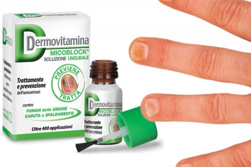 In questa recensione parliamo di Dermovitamina MicoBlock Soluzione Ungueale (Dispositivo Medico indicato nel trattamento dell'Onicomicosi), analizzandone efficacia, funzionamento, uso corretto e possibili effetti collaterali