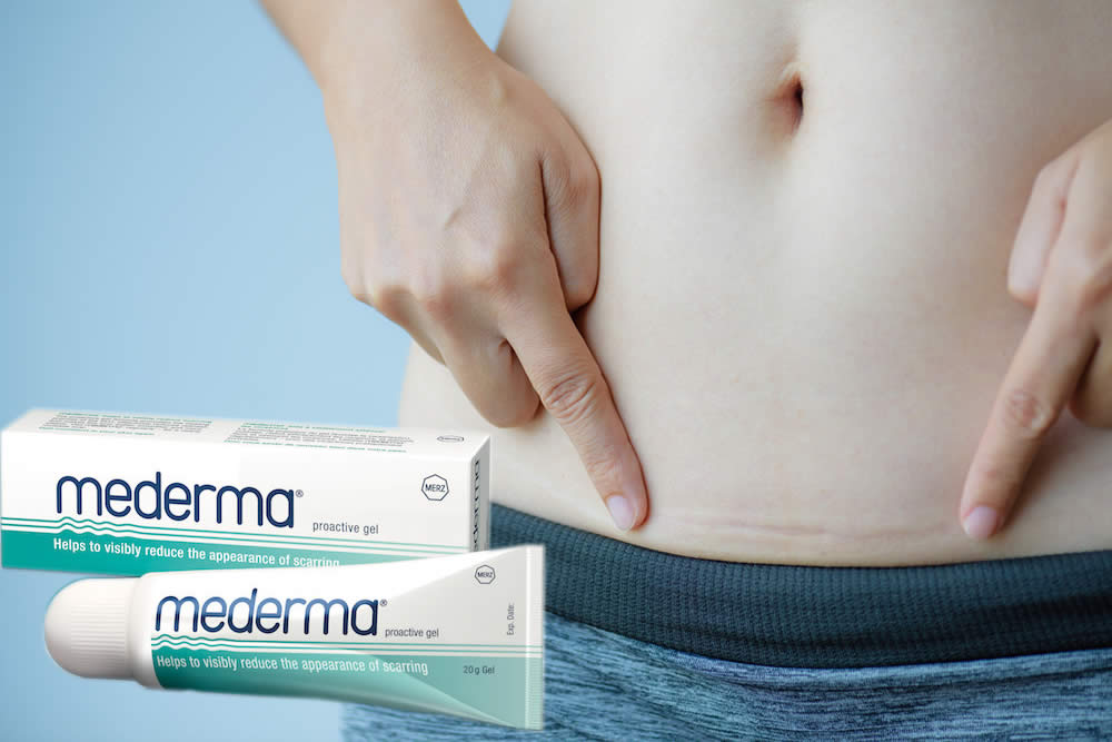 Mederma